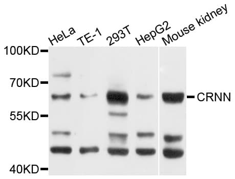Polyclonal Rabbit anti-Human CRNN / Cornulin Antibody (WB)
