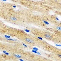 Polyclonal Rabbit anti-Human NCF2 / NOXA2 / p67phox Antibody (IHC, IF, WB)