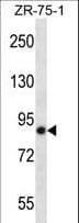 LRRN4 / C20orf75 Antibody (aa557-586)