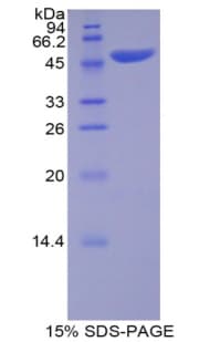 Pig APOB / Apolipoprotein B (Recombinant His-GST)