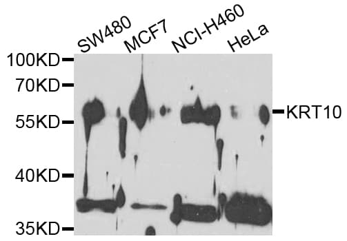 KRT10 / CK10 / Cytokeratin 10 Antibody