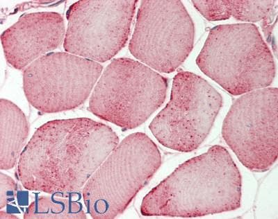 IHC-plus™ DIS3L2 Antibody