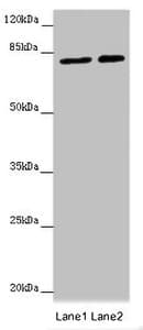 Polyclonal Rabbit anti-Human DDX33 / DHX33 Antibody (IHC, IF, WB)