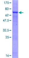 Human PRKX Protein (Recombinant GST)