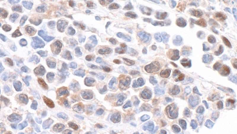 GAPDH Antibody (aa300-C-term)