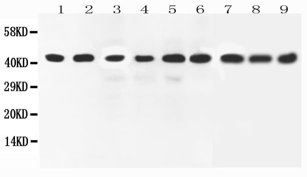 MAPK1 / ERK2 Antibody (aa324-335)