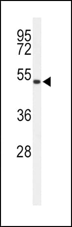 ASMT / HIOMT Antibody (aa212-241)