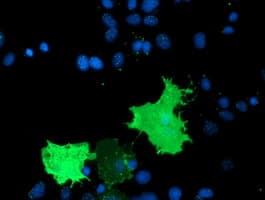 TULP3 Antibody (clone OTI7B8)