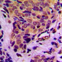 EIF4EBP1 / 4EBP1 Antibody (phospho-Thr37)