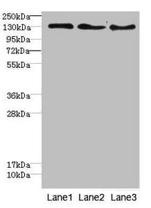 RBP2 / CRBPII Antibody