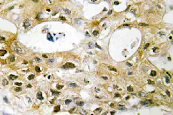 Polyclonal Rabbit anti-Human TOP2A / Topoisomerase II Alpha Antibody (Glu1102, IHC, WB)