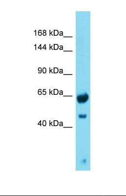 Polyclonal Rabbit anti-Human GREB1 Antibody (aa151-200, WB)