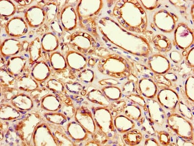 F8 / FVIII / Factor VIII Antibody