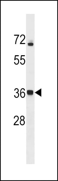 Polyclonal Rabbit anti-Human CALHM3 Antibody (aa68-97, WB)