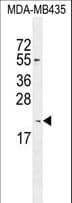 KLLN / KILLIN Antibody (aa136-163)