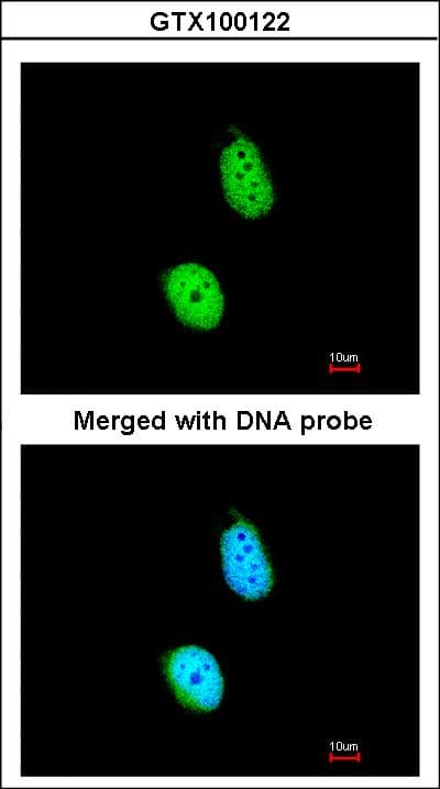 Polyclonal Rabbit anti-Human CSA / ERCC8 Antibody (IF, WB)