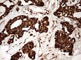 Monoclonal Mouse anti-Human GAPDH Antibody (clone OTI2F8, IHC, WB)