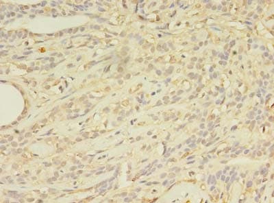 Polyclonal Rabbit anti-Human ABCB5 Antibody (IHC)