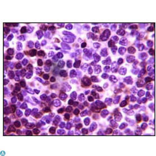 ZAP70 Antibody