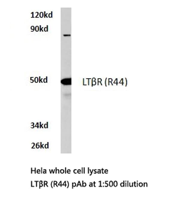LTBR Antibody (Arg44)