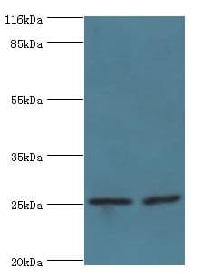 Vps60 / CHMP5 Antibody (aa1-219)