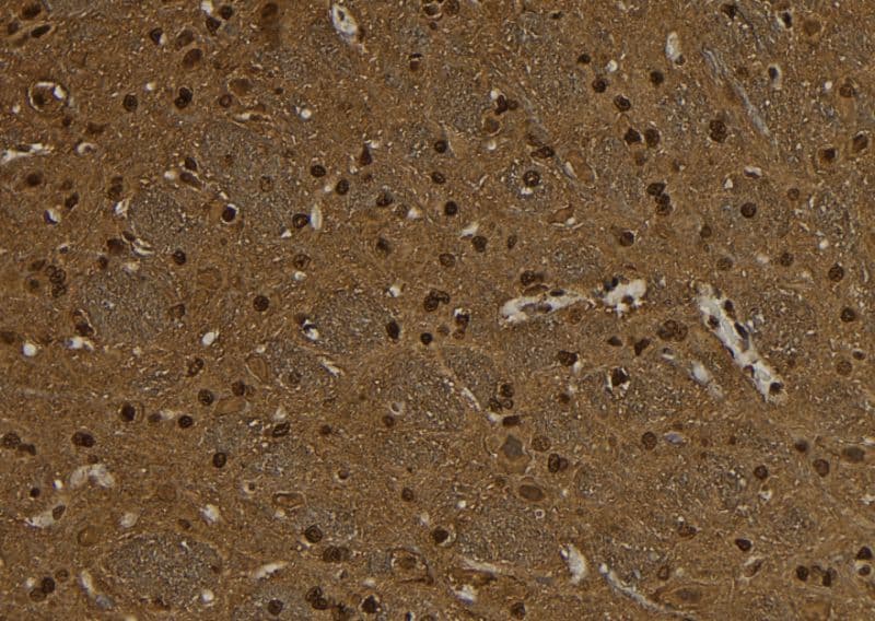 SNRPD3 Antibody
