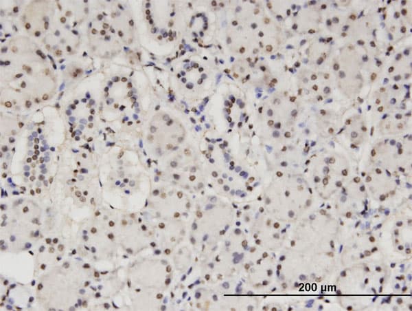 CBFA2T2 / MTGR1 Antibody (clone 2C10)