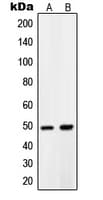 PDK1 Antibody (Internal)