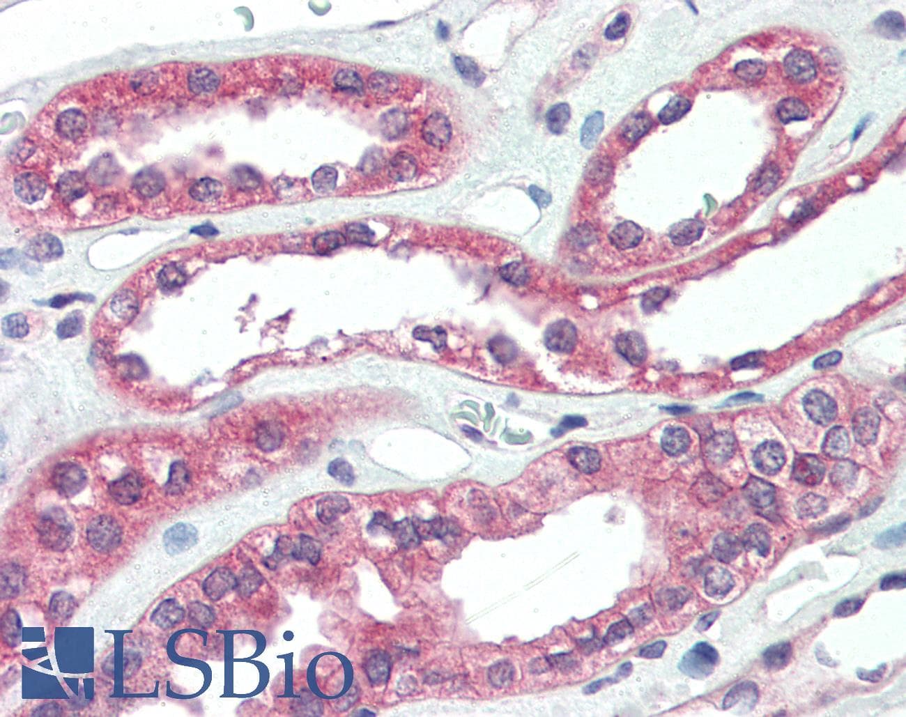 IHC-plus™ ARHGEF17 / TEM4 Antibody