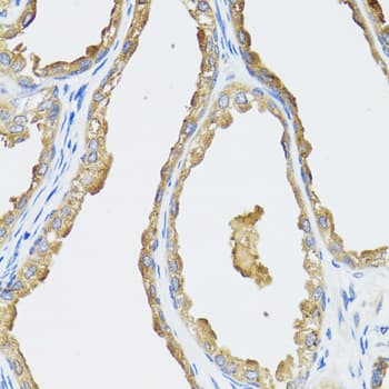 Polyclonal Rabbit anti-Human CYP19 / Aromatase Antibody (IHC, WB)
