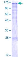 Human DDIAS Protein (Recombinant GST)