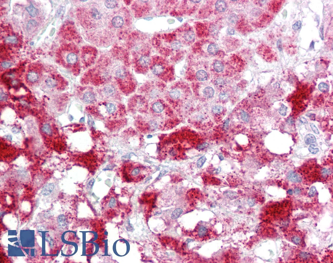 IHC-plus™ SIK2 / SNF1LK2 Antibody