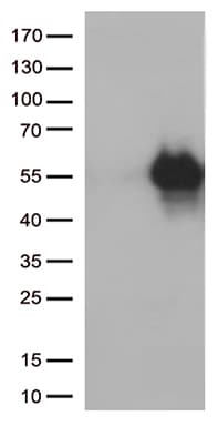 Monoclonal Mouse anti-Human HAVCR2 / TIM-3 Antibody (clone OTI10B1, WB)