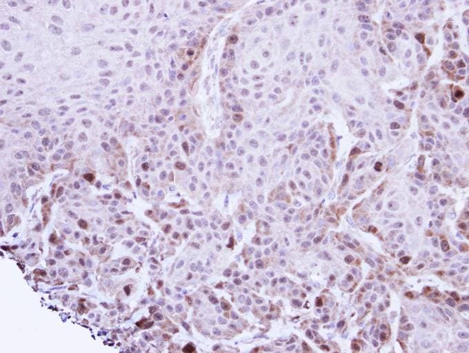 TACC2 Antibody (aa237-293)
