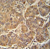 Polyclonal Rabbit anti-Human ATP5D Antibody (aa1-30, IHC, WB)