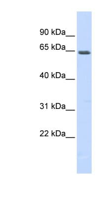 Polyclonal Rabbit anti-Human MEF2A / MEF2 Antibody (N-Terminus, WB)
