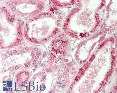 IHC-plus™ CYP27 / CYP27A1 Antibody (aa101-150)