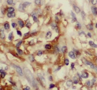 CCL20 / MIP-3-Alpha Antibody