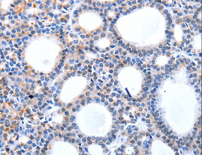 HCN1 Antibody