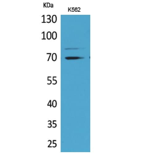Polyclonal Rabbit anti-Human KEAP1 Antibody (411-460 aa, Internal, WB)