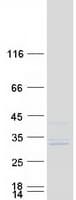 Human MRPS7 Protein (Recombinant Myc-DDK (Flag))