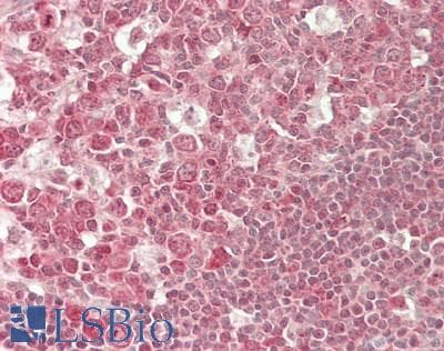 IHC-plus™ USP10 Antibody (aa50-100)