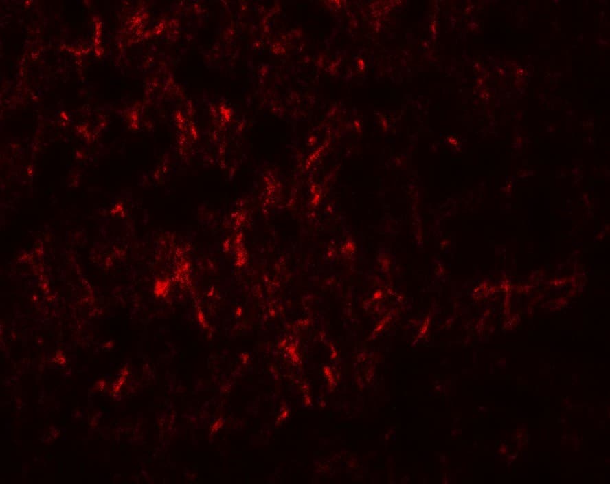IHC-plus™ Polyclonal Rabbit anti-Human SLC29A4 Antibody (IHC, IF, WB)