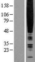 CHEMR23 / CMKLR1 Protein (Over-Expression Lysate Myc-DDK (Flag))