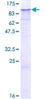 Human ZNF287 Protein (Recombinant GST)