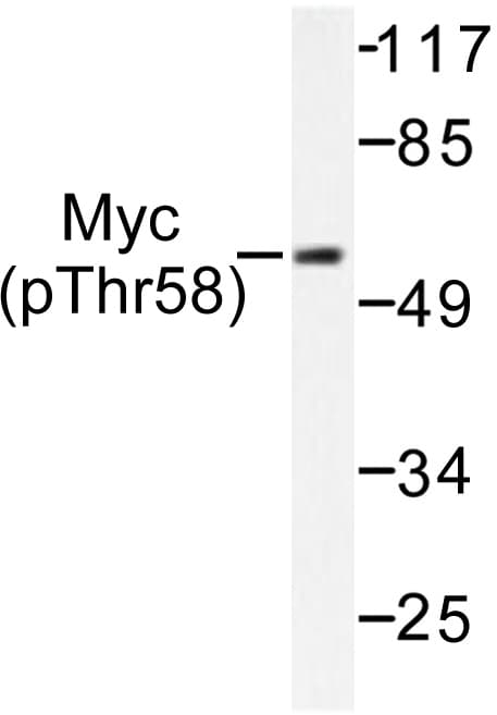 MYC / c-Myc Antibody (phospho-Thr58)