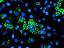 AK4 / Adenylate Kinase 4 Antibody (clone OTI3B1, Carrier-free)