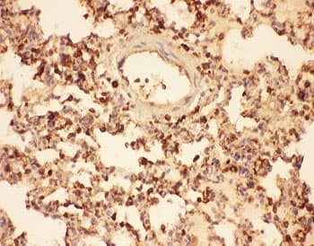 CFL1 / Cofilin Antibody (aa2-166)