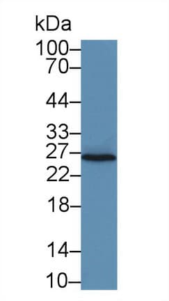 IL-22BP / IL22RA2 Antibody (aa30-228)