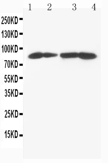 Polyclonal Rabbit anti-Human MTA1 Antibody (aa676-696, IHC, WB)